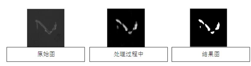 液晶屏幕視覺檢測(cè)，液晶屏幕劃痕污點(diǎn)缺陷檢測(cè)方案-機(jī)器視覺_視覺檢測(cè)設(shè)備_3D視覺_缺陷檢測(cè)